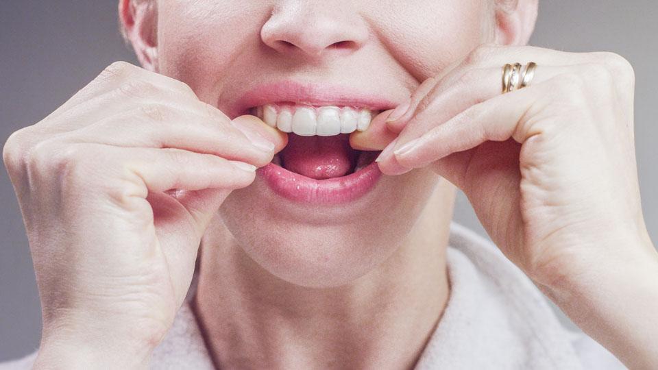 Hampaiden valkaisu kotona tehdään mm. valkaisulusikoilla, hammastahnalla ja valkaisuliuskoilla.